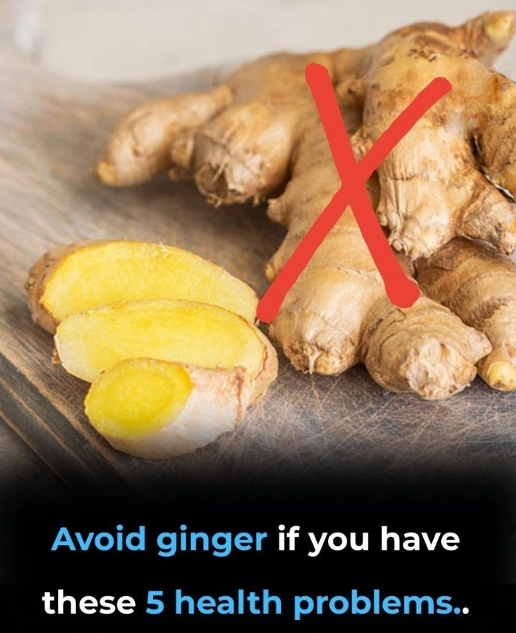 Avoid ginger if you have these 5 health problems