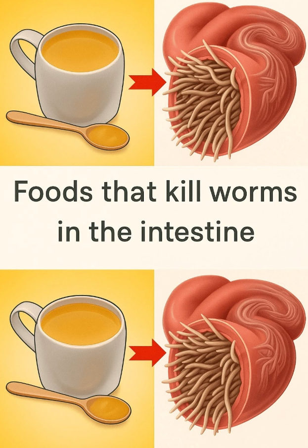 Foods that kill worms in the intestine: Natural remedies for optimal gut health