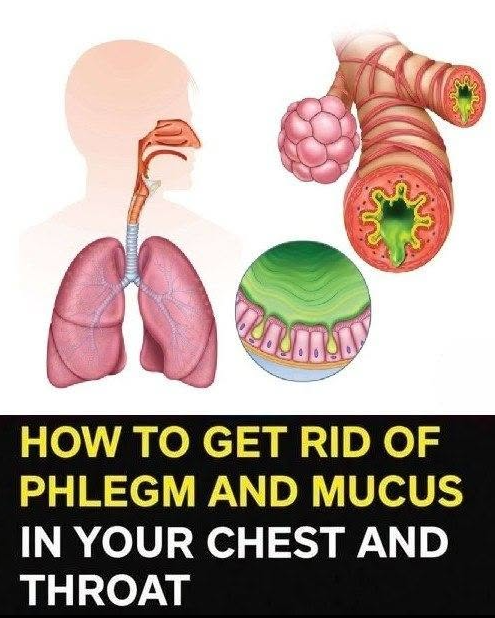 How to Get Rid of Phlegm and Mucus in Chest and Throat Naturally